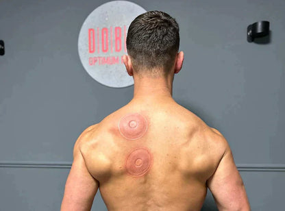 Rechargeable Cupping Massage Device