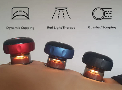 Rechargeable Cupping Massage Device